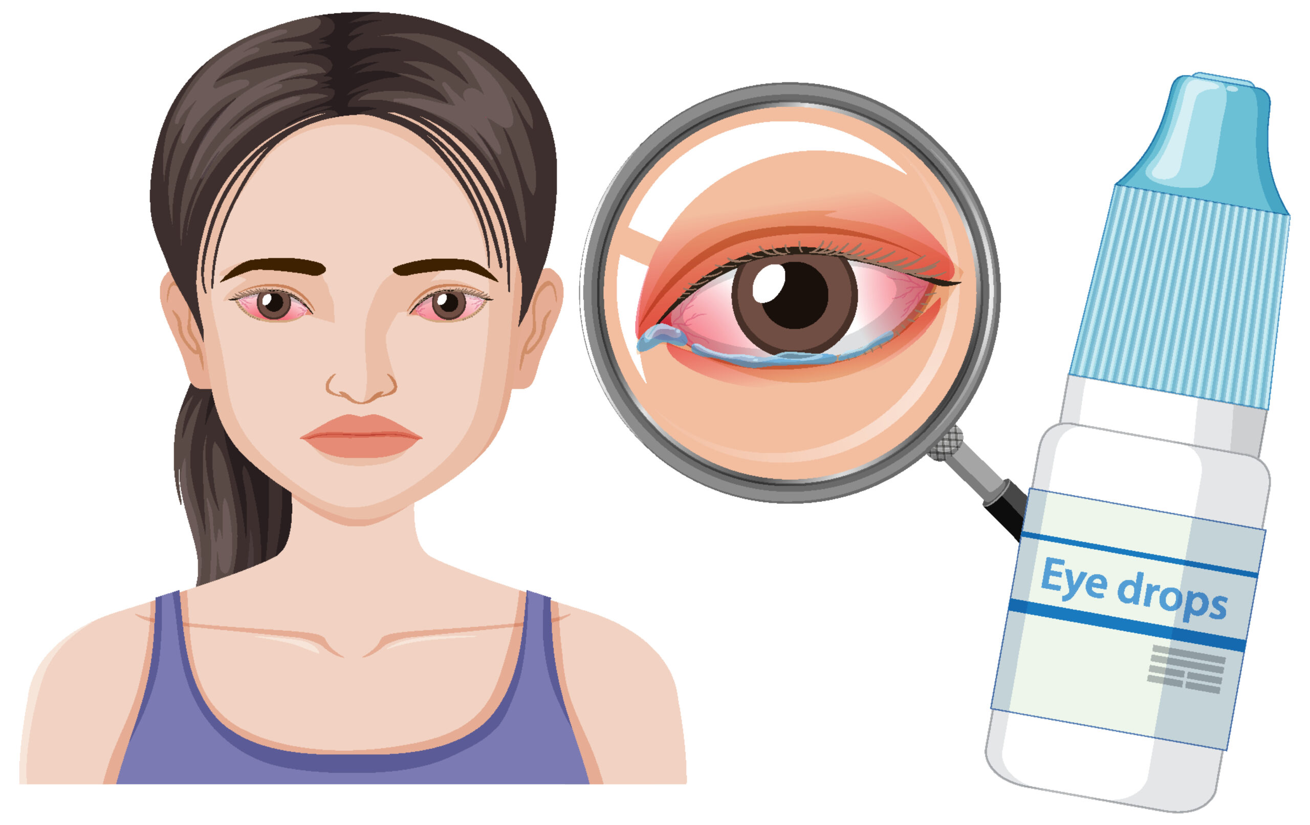 What Is Dry Eye Symptoms Causes Treatment MiVision What Is Dry Eye Symptoms Causes Treatment MiVision