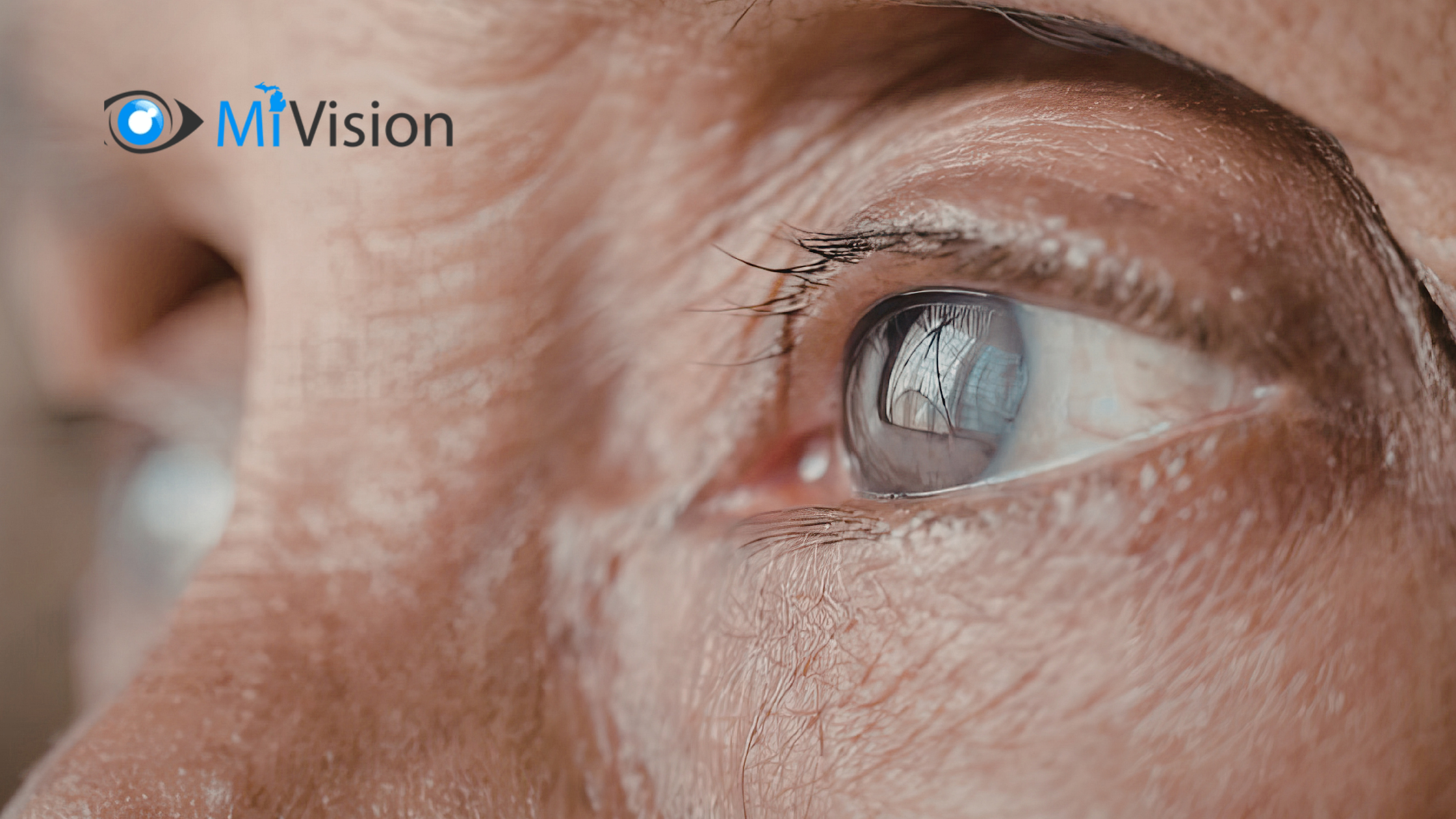 Cataract Surgery