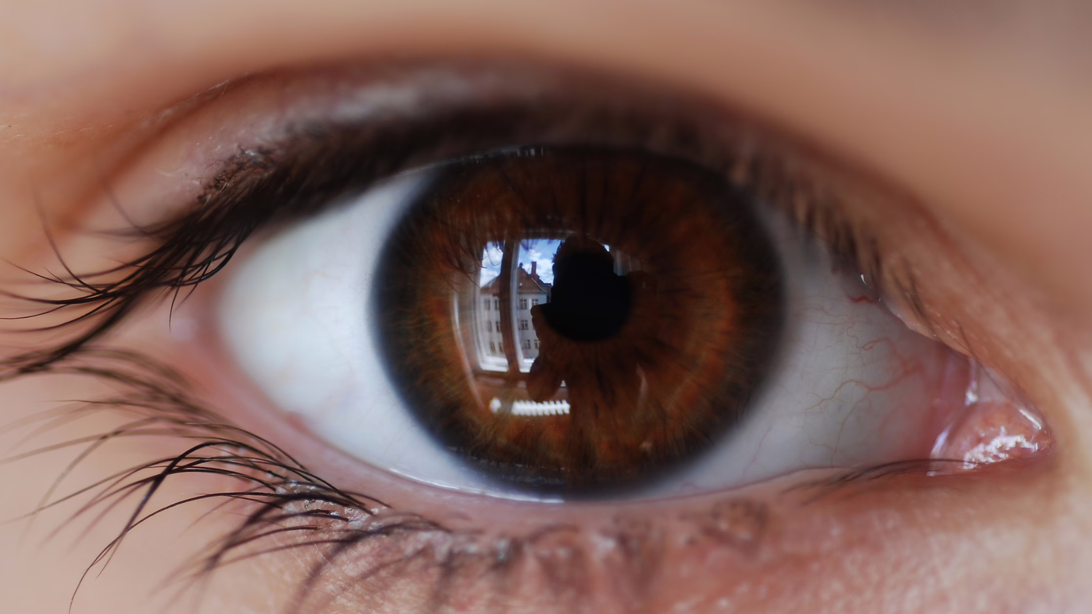 Phacoemulsification